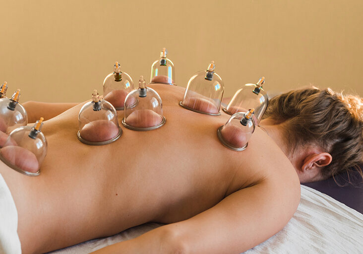 Female_Cupping_Therapy_